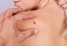 Terapia czerniaka – coraz skuteczniejsza Leczenie czerniaka w Polsce