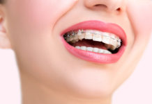 Wskazania do wizyty u ortodonty Kiedy do ortodonty