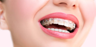 Wskazania do wizyty u ortodonty Kiedy do ortodonty