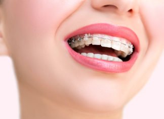 Wskazania do wizyty u ortodonty Kiedy do ortodonty