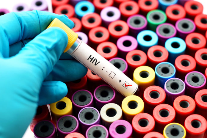 badanie próbki krwi HIV