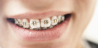 Wada zgryzu u dziecka – konsekwencje i powikłania Aparat ortodontyczny u dziecka