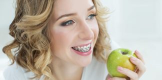 Aparat ortodontyczny a codzienna dieta kobieta z aparatem na zębach
