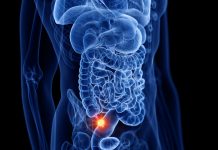 Po co nam wyrostek robaczkowy? anatomia wyrostek robaczkowy