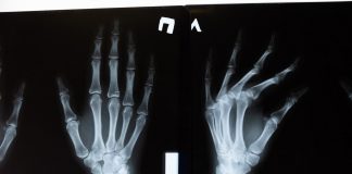 Badanie RTG – jak się do niego przygotować? badanie rtg