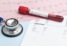 Badanie poziomu cholesterolu: jak odczytać lipidogram? Lipid Panel EKG