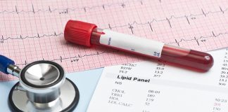 Badanie poziomu cholesterolu: jak odczytać lipidogram? Lipid Panel EKG