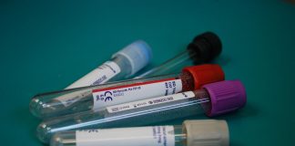 Bilirubina całkowita – co to jest i co jej poziom oznacza dla naszego zdrowia? bilirubina całkowita