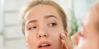 Sucha skóra – jak zabezpieczyć cerę i usta przed mrozem? skóra na mrozie