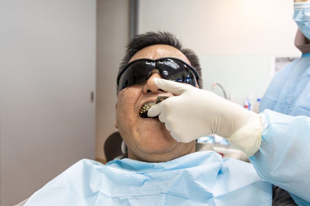 pobranie wycisków naturalnego zęba pacjenta u stomatologa